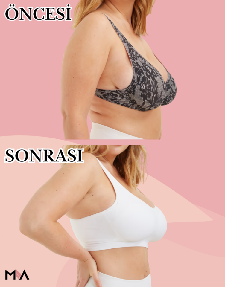 Mia Göğüs Toparlayıcı Sütyen